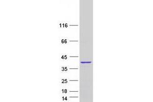Western Blotting (WB) image for KIAA1191 (KIAA1191) (Transcript Variant 3) protein (Myc-DYKDDDDK Tag) (ABIN2724206)