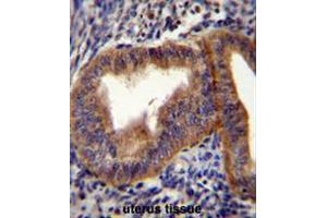 CCNB1 Antibody (Center) immunohistochemistry analysis in formalin fixed and paraffin embedded human uterus tissue followed by peroxidase conjugation of the secondary antibody and DAB staining.