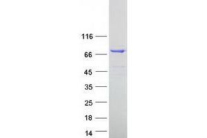 Western Blotting (WB) image for Epithelial Splicing Regulatory Protein 1 (ESRP1) (Transcript Variant 1) protein (Myc-DYKDDDDK Tag) (ABIN2720521)
