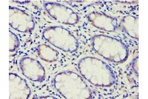 Immunohistochemistry (IHC) image for anti-ATP-Binding Cassette, Sub-Family F (GCN20), Member 2 (ABCF2) (AA 1-250) antibody (ABIN7144925)