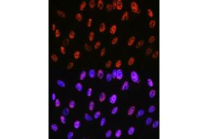 Immunofluorescence analysis of C6 cells using P Rabbit mAb (ABIN7269445) at dilution of 1:100 (40x lens). (PABPN1 抗体)