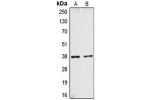 Western blot analysis of CYSLTR1 expression in A10 (A), HT29 (B) whole cell lysates.