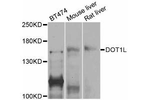 Western blot analysis of extracts of various cell lines, using DOT1L antibody (ABIN5997612) at 1/1000 dilution. (DOT1L 抗体)