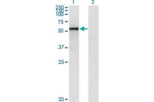 Western Blot analysis of ENG expression in transfected 293T cell line by ENG monoclonal antibody (M01), clone 4C11. (Endoglin 抗体  (AA 27-658))