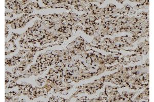 ABIN6273210 at 1/100 staining Human lung tissue by IHC-P. (CNOT10 抗体  (Internal Region))