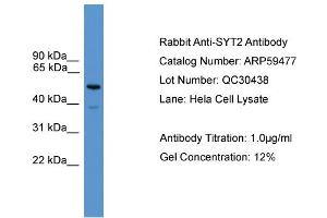 WB Suggested Anti-SYT2  Antibody Titration: 0. (SYT2 抗体  (C-Term))