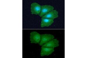anti-Acireductone Dioxygenase 1 (ADI1) (AA 1-179) antibody