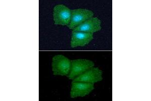 ICC/IF analysis of ADI1 in Hep3B cells line, stained with DAPI (Blue) for nucleus staining and monoclonal anti-human ADI1 antibody (1:100) with goat anti-mouse IgG-Alexa fluor 488 conjugate (Green). (ADI1 抗体)