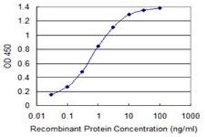 Detection limit for recombinant GST tagged RAB1B is 0. (RAB1B 抗体  (AA 91-201))