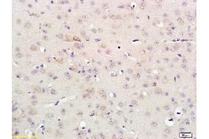 Formalin-fixed and paraffin embedded rat brain labeled with Anti-FGFR3/CD333 Polyclonal Antibody, Unconjugated (ABIN674664) at 1:200 followed by conjugation to the secondary antibody and DAB staining