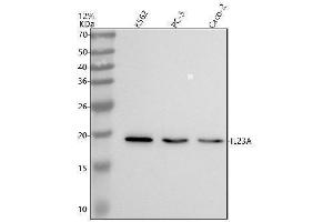 Western blot analysis of IL23 using anti-IL23 antibody (ABIN7605257).