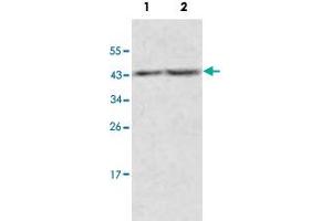 Western blot analysis of human fetal kidney (Lane 1) and fetal thymus (Lane 2) lysate with ACOT9 polyclonal antibody  at 1 : 500 dilution. (ACOT9 抗体  (AA 3-212))