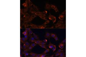 Immunofluorescence analysis of C6 cells using Neuropilin-1 (Neuropilin-1 (NRP1)) antibody (ABIN7268892) at dilution of 1:100. (Neuropilin 1 抗体  (AA 21-250))