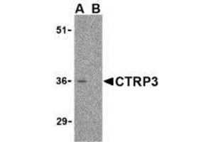 Western blot analysis of CTRP3 in mouse heart cell lysate with AP30251PU-N CTRP3 antibody at 1 μg/ml in the (A) absence and (B) presence of blocking peptide. (C1QTNF3 抗体  (Intermediate Domain))