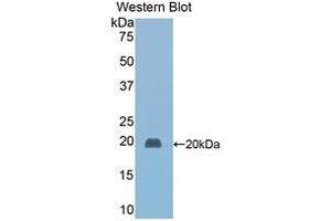 Western Blotting (WB) image for anti-Haptoglobin (HP) (AA 118-281) antibody (ABIN1078101) (Haptoglobin 抗体  (AA 118-281))