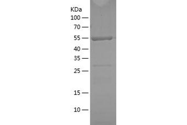 TRAF2 Protein (AA 306-501) (His-IF2DI Tag)