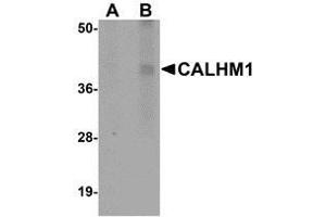 Western blot analysis of CALHM1 in rat liver tissue lysate with AP30176PU-N CALHM1 antibody at (A) 1 and (B) 2 μg/ml. (CALHM1 抗体  (N-Term))