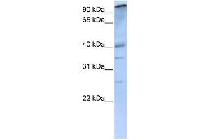WB Suggested Anti-PCAF Antibody Titration: 0. (KAT2B 抗体  (C-Term))