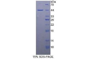 SDS-PAGE analysis of Rat Nephrin Protein. (Nephrin 蛋白)