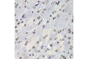 Immunohistochemistry of paraffin-embedded mouse brain using PSMB10 antibody at dilution of 1:200 (400x lens). (PSMB10 抗体)