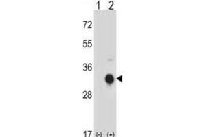 Western Blotting (WB) image for anti-Kallikrein 10 (KLK10) antibody (ABIN2998072)