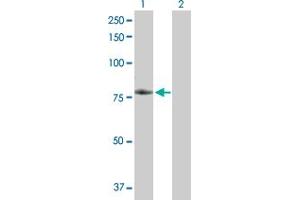 Western Blotting (WB) image for anti-Tumor Necrosis Factor Receptor Superfamily, Member 21 (TNFRSF21) (AA 1-655) antibody (ABIN525915)