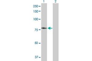 Western Blot analysis of TNFRSF21 expression in transfected 293T cell line by TNFRSF21 MaxPab polyclonal antibody. (TNFRSF21 抗体  (AA 1-655))