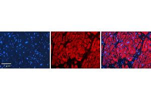 Rabbit Anti-CBR1 Antibody   Formalin Fixed Paraffin Embedded Tissue: Human heart Tissue Observed Staining: Cytoplasmic Primary Antibody Concentration: N/A Other Working Concentrations: 1:600 Secondary Antibody: Donkey anti-Rabbit-Cy3 Secondary Antibody Concentration: 1:200 Magnification: 20X Exposure Time: 0. (CBR1 抗体  (Middle Region))
