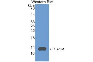 Detection of Recombinant ITaC, Mouse using Polyclonal Antibody to Interferon Inducible T-Cell Alpha Chemoattractant (ITaC) (CXCL11 抗体  (AA 22-100))