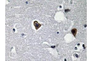 Immunohistochemistry analyzes of Sarcoglycan-β antibody in paraffin-embedded human brain tissue. (SGCB 抗体)