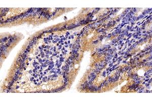 Detection of C1QBP in Mouse Small intestine Tissue using Polyclonal Antibody to Complement component 1 Q subcomponent-binding protein, mitochondrial (C1QBP) (C1QBP 抗体  (AA 71-278))