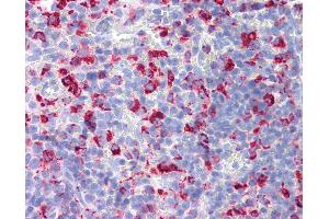 Anti-CD68 antibody IHC of rat spleen. (CD68 抗体)