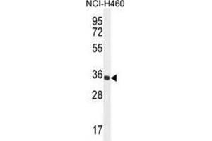 Western blot analysis in NCI-H460 cell line lysates (35ug/lane) using Trypsin-1 / PRSS1  Antibody . (PRSS1 抗体  (Middle Region))