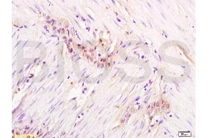 Formalin-fixed and paraffin embedded rat colon labeled with Anti-Gemin 2 Polyclonal Antibody, Unconjugated  at 1:200 followed by conjugation to the secondary antibody and DAB staining. (SIP1 抗体  (AA 51-150))