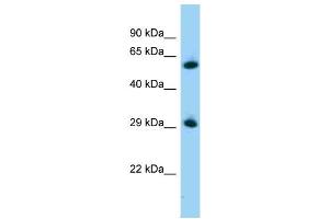 WB Suggested Anti-Zbtb7a Antibody   Titration: 1. (ZBTB7A 抗体  (C-Term))