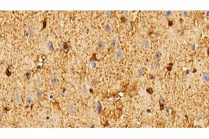 Immunohistochemistry (IHC) image for anti-S100 Calcium Binding Protein B (S100B) (AA 1-92) antibody (ABIN7442840)