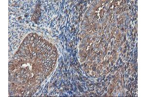 Image no. 10 for anti-Tubulin, alpha-Like 3 (TUBAL3) (AA 150-446) antibody (ABIN1490956)