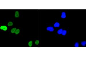 HeLa cells were stained with c-Myc(S62) (1A7 ) Monoclonal Antibody (b at [1:200] incubated overnight at 4C, followed by secondary antibody incubation, DAPI staining of the nuclei and detection. (c-MYC 抗体  (pSer62))