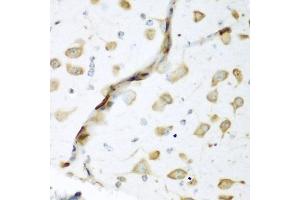 Immunohistochemistry of paraffin-embedded mouse brain using EL antibody (ABIN6134649, ABIN6140114, ABIN6140116 and ABIN6221621) at dilution of 1:200 (40x lens). (ELAVL2 抗体  (AA 1-100))