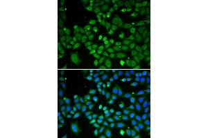 Immunofluorescence analysis of A549 cell using ECI1 antibody. (DCI 抗体  (AA 63-302))