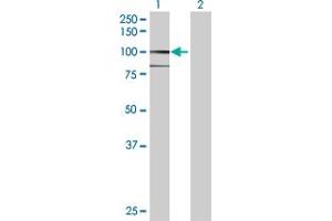Western Blotting (WB) image for anti-Amine Oxidase, Copper Containing 3 (Vascular Adhesion Protein 1) (AOC3) (AA 1-763) antibody (ABIN522088)