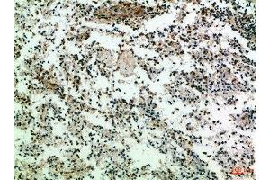 Immunohistochemical analysis of paraffin-embedded Human-spleen, antibody was diluted at 1:100 (CD247 抗体  (AA 51-100))