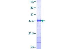 Image no. 1 for Golgi Membrane Protein 1 (GOLM1) (AA 302-401) protein (GST tag) (ABIN1355471) (GOLM1 Protein (AA 302-401) (GST tag))