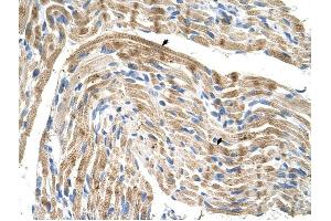 FADS1 antibody was used for immunohistochemistry at a concentration of 4-8 ug/ml to stain Skeletal muscle cells (arrows) in Human Muscle. (FADS1 抗体  (C-Term))
