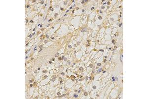 Immunohistochemistry (IHC) image for anti-Claudin 11 (CLDN11) antibody (ABIN1871890) (Claudin 11 抗体)