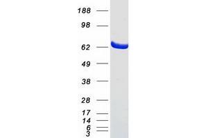 Western Blotting (WB) image for Carnitine O-Octanoyltransferase (CROT) (Transcript Variant 2) protein (Myc-DYKDDDDK Tag) (ABIN2712566)