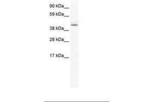 DDX49 antibody  (AA 81-130)
