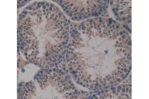 Used in DAB staining on fromalin fixed paraffin- embedded Kidney tissue (DHPS 抗体  (AA 1-369))