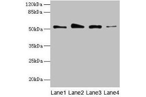 Western blot All lanes: GSDMD antibody at 4 μg/mL Lane 1: Jurkat whole cell lysate Lane 2: Hela whole cell lysate Lane 3: A431 whole cell lysate Lane 4: U251 whole cell lysate Secondary Goat polyclonal to rabbit IgG at 1/10000 dilution Predicted band size: 53 kDa Observed band size: 53 kDa (GSDMD 抗体  (AA 1-256))