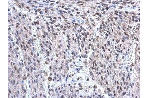 IHC-P Image hnRNP F antibody [N1N3] detects hnRNP F protein at nucleus on mouse uterus by immunohistochemical analysis. (HNRNPF 抗体)
